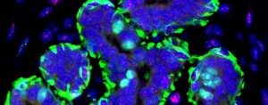 normal breast telomere FISH staining-1140x450